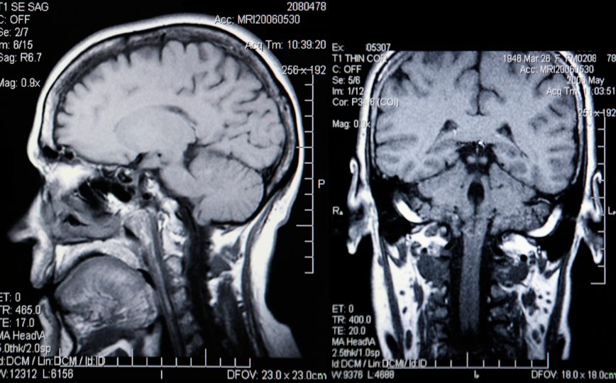 Научное обоснование гипноза